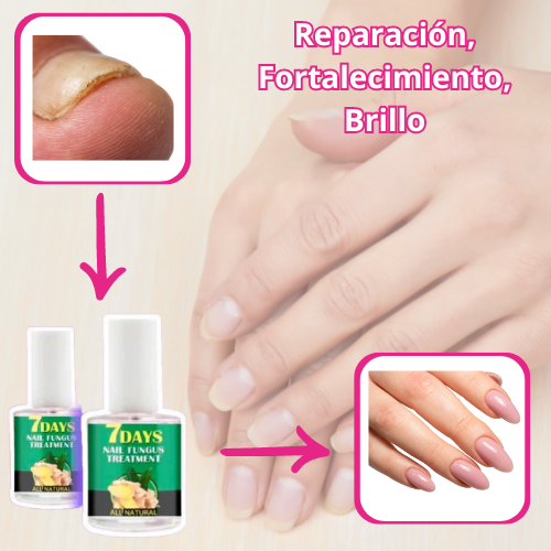 Uñas de Hierro® Endurecedor Para Uñas x3und