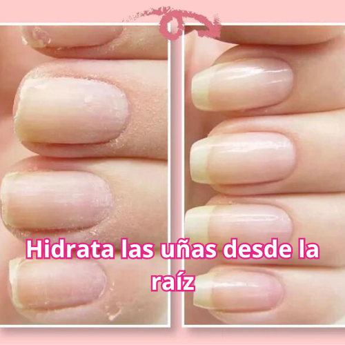 Uñas de Hierro® Endurecedor Para Uñas x3und